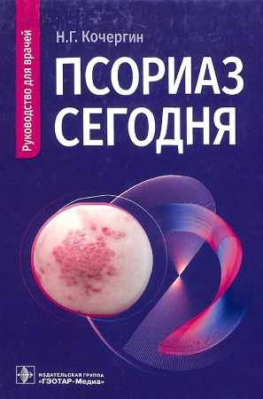 Псориаз сегодня